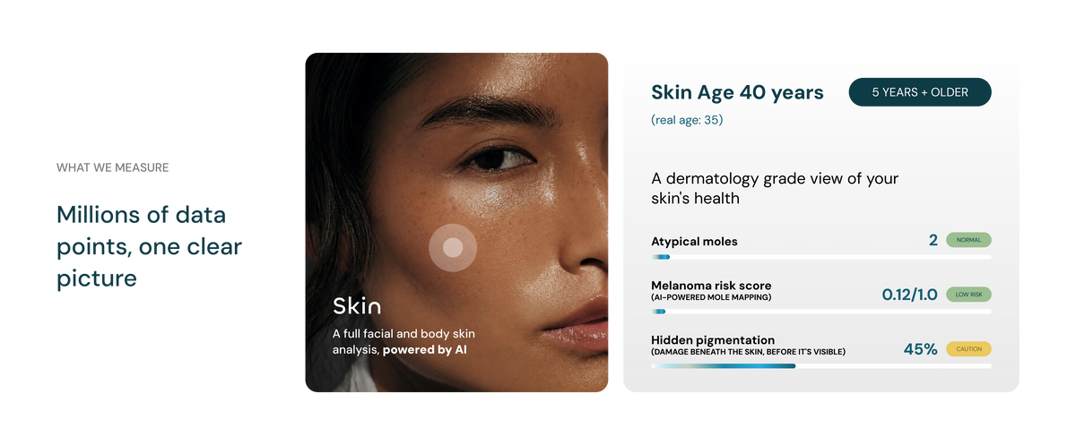 Skin
