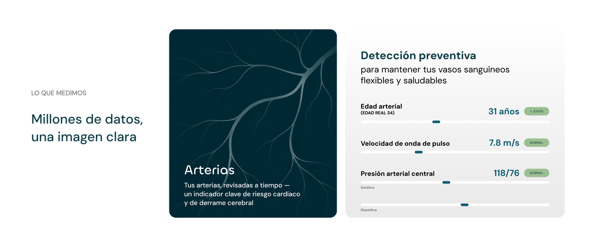 Arterias