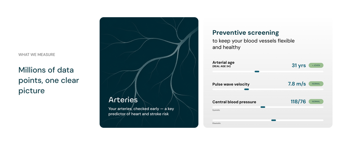 Arteries