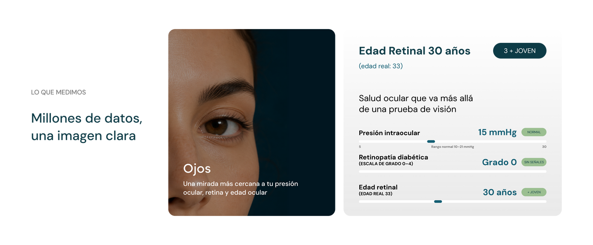Ojos
